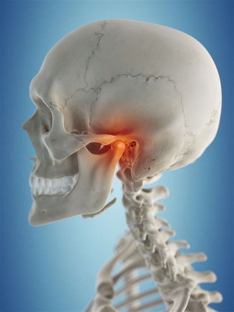 Is Your Neck Pain Related to Your Jaw Joint?