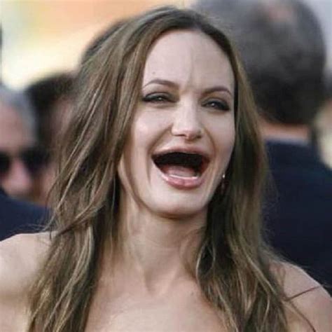 10 Hilarious Photos Of Celebrities Without Teeth