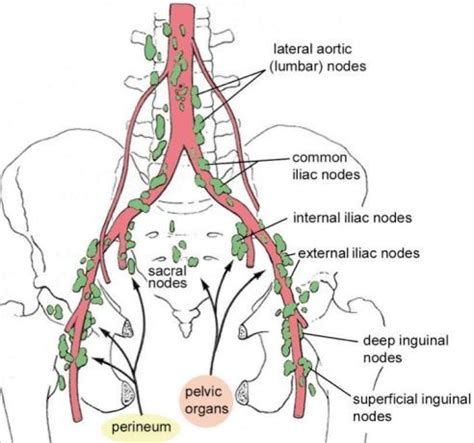 lymphatic drainage of the pelvis Diagram | Quizlet