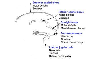 Cerebral venous thrombosis - WikEM