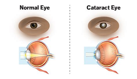 Mackey Vision Center - Optical, Medical & Surgical Eye Care in Corbin, KY