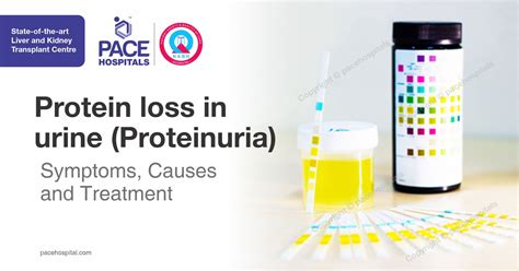 Protein loss in urine (Proteinuria) - Symptoms, Causes and Treatment