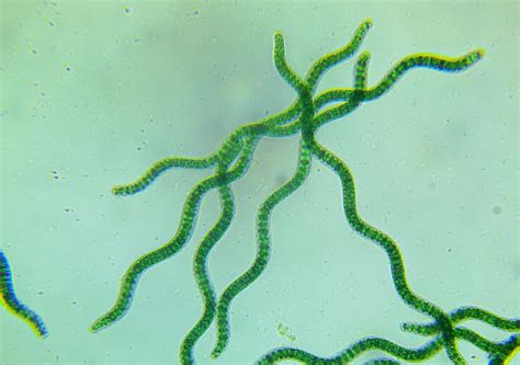 Spirulina Maxima Microscopy Sample TBSSM-1 Living Algae – Algae-Lab