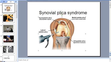 PLICA 1 - YouTube