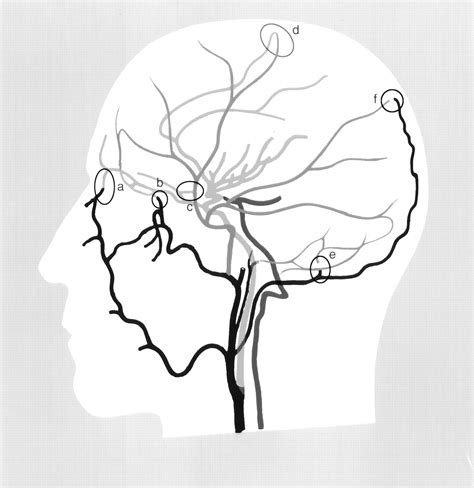 Collateral Circulation | Stroke