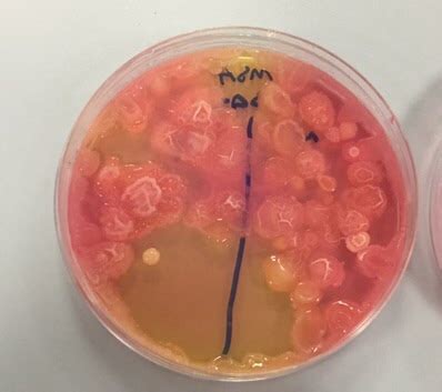 Does anyone know what this could be on my mannitol salt agar plate?