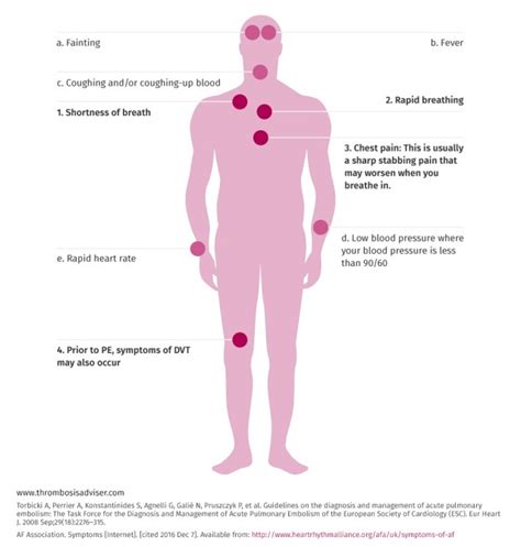Symptoms Of Pulmonary Embolism
