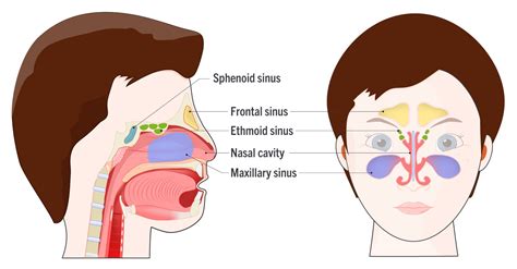 Blocked Nose Sinusitis Clearance Outlet, Save 65% | jlcatj.gob.mx