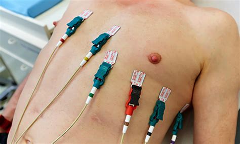 How To Take Ecg Procedure : Enveloping Procedure The Flattened Ecg F Is Constructed By Download ...