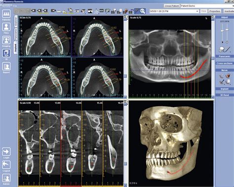 Digitales Röntgen/DVT-3D Röntgen › Zahnarztpraxis Hanft