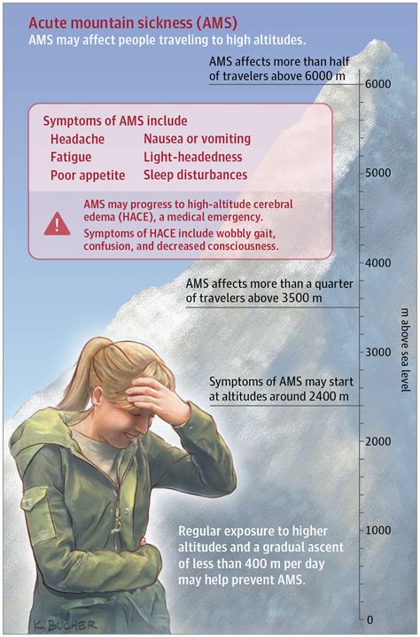 Symptoms of altitude sickness - palsqust