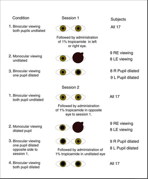 The Enright phenomenon. Stereoscopic distortion of perceived driving speed induced by monocular ...