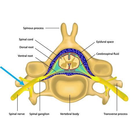 Periradicular therapies (PRT) | Orthopaedie - Schmerztherapie