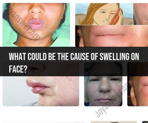 Facial Swelling Causes: Exploring Possible Reasons - JoyAnswer.org