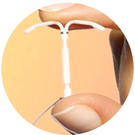 Types of IUDs | CU PAG