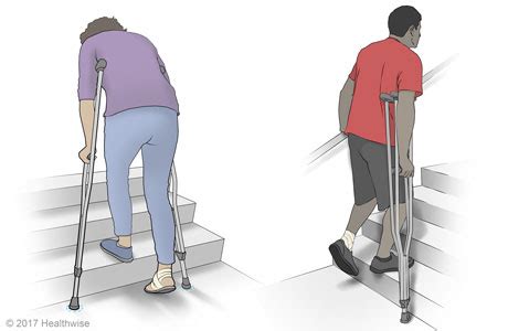 Using Crutches Information