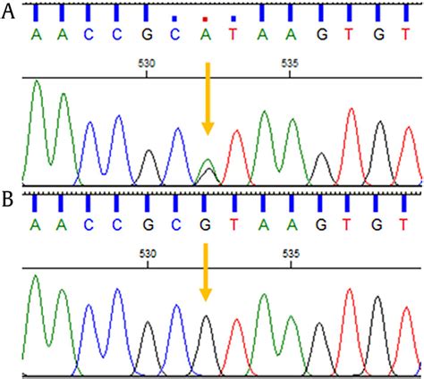 The Sanger sequencing electropherograms. Proband with heterozygous ...