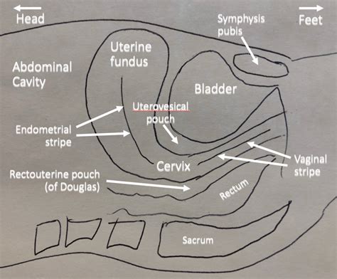 Pelvic Ultrasound: Sagittal Anatomy