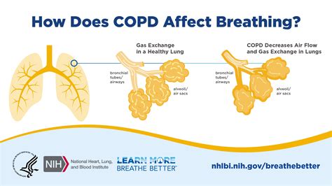 How Does COPD Affect Breathing – Region 7 Update