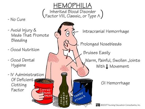 Life With Hemophilia - All About Hemophilia