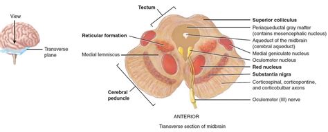 Brain stem anatomy, function, brain stem stroke & brain stem tumor