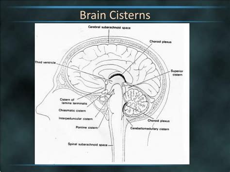 PPT - Brain Cisterns PowerPoint Presentation - ID:2263744 Ppt ...