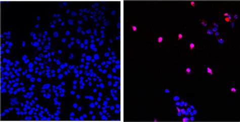 Promising Drug That Can Kill All Solid Tumor Cancers | NextBigFuture.com