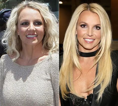 Britney Spears Plastic Surgery Before and After Botox Injections | Celebie