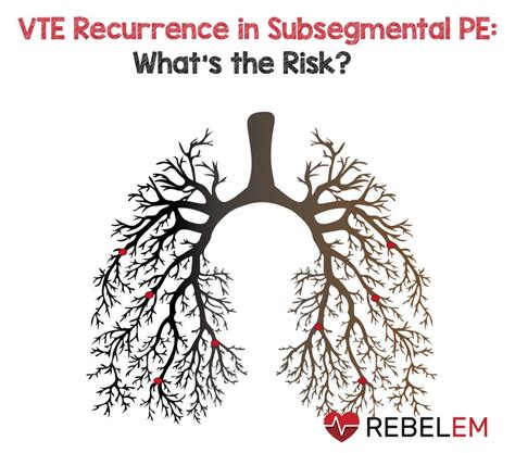 VTE Recurrence in Subsegmental PE: What’s the Risk? – MED-TAC ...