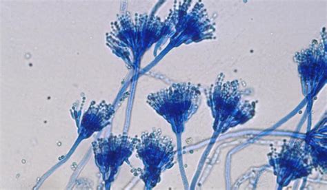 Aspergillus: niger, fumigatus, flavus, oryzae, ochraceus, glaucus что ...