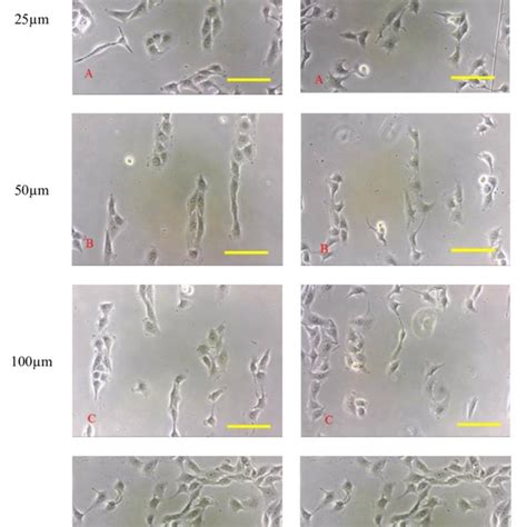 Images of HT29 cell line on glass coverslips micro-contact printed with ...