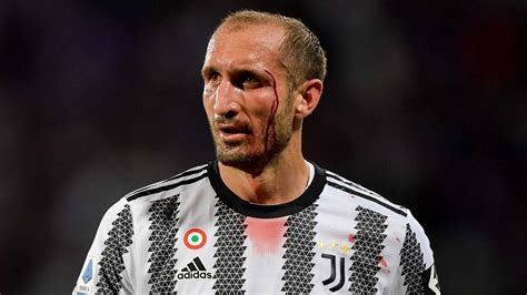 Top 999+ Giorgio Chiellini Wallpaper Full HD, 4K Free to Use