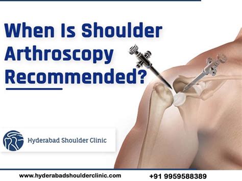 When Is Shoulder Arthroscopy Recommended? - shoulder clinic Hyderabad