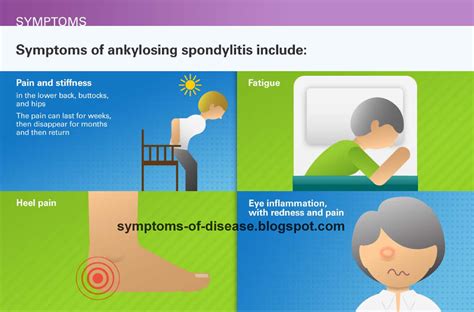 ankylosing spondylitis symptoms – Lakeside Volunteer Rescue Squad