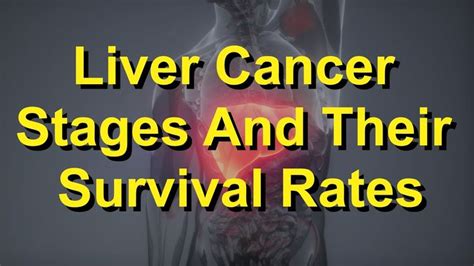 Liver Cancer Stages And Their Survival Rates | Cancer stages, Liver ...