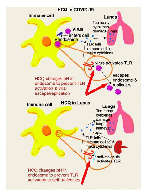 The Plaquenil, COVID-19, Lupus Connection: “This drug saves lives, I’m living proof…” | by ...