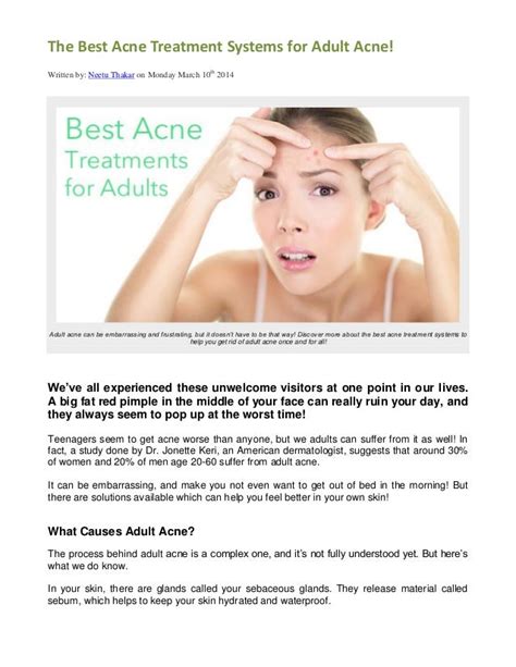 The Best Acne Treatment Systems for Adult Acne