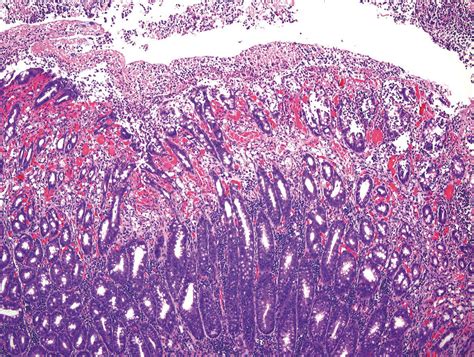 Diseases Produced by Clostridium perfringens type D | Veterian Key