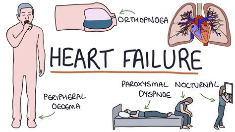 Heart Failure Cartoon - The best gifs are on giphy. - Frikilo Quesea