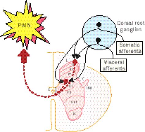 Visceral pain - The Lancet