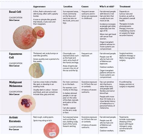 Skin Cancer Types Chart