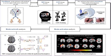 Current treatment approach with our mind, not our body: Motor Imagery | BULB