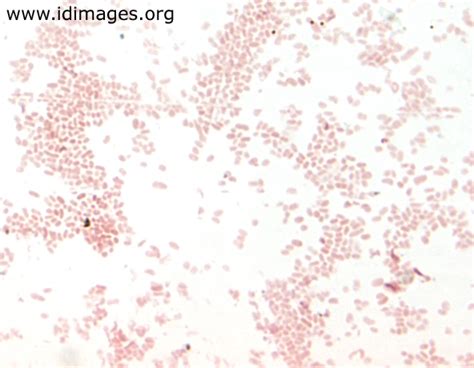 Haemophilus Influenzae Gram Stain - Pin By Nancy De Jesus Torres On Bio Microbiology Medical ...