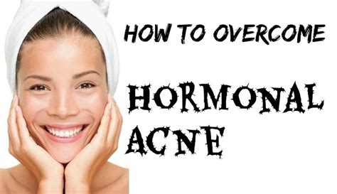 Hormonal Acne Causes. How To Treat and Get Rid of Hormonal Acne