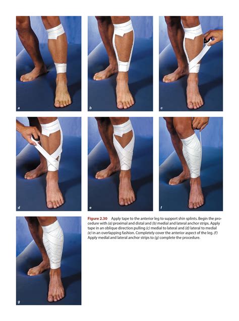 Shin Splints - Taping Techniques - Human Kinetics Blog