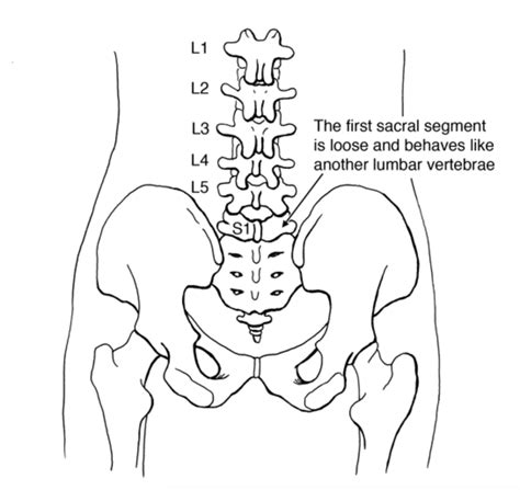 Pin on back pain