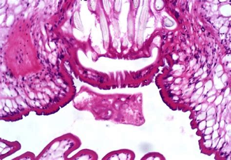 x 400mag. Sections show larval form containing scolex and hooklets.... | Download Scientific Diagram