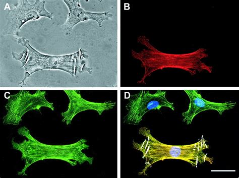 Alpha-Smooth Muscle Actin Expression Upregulates Fibroblast Contractile ...