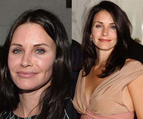 Courteney Cox before and after plastic surgery (24) – Celebrity plastic ...