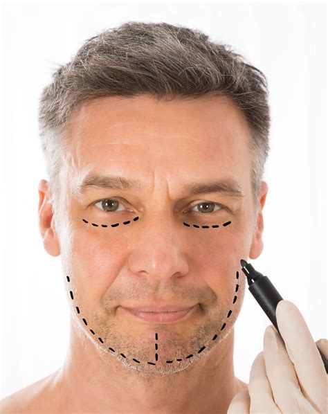 Laser Face Lifting - Toronto Facial Plastic Surgery and Laser Centre | Dr. Torgerson